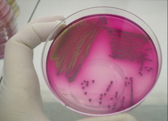 Endo agar 大肠杆菌